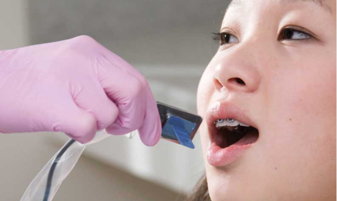 Ultimate Dental Sensor Guide: Tips And Recommendations